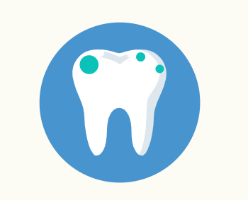 Composite Fillings