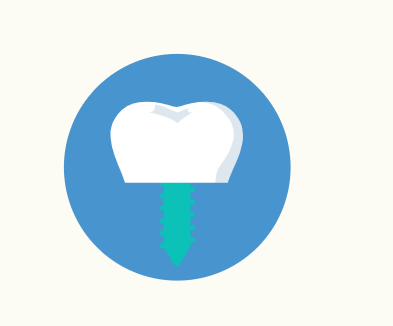 Dental Implants in south gate